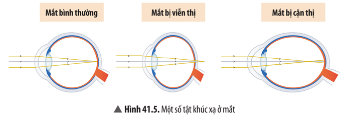 quan sát hình 41.5 và bảng 41.1, hãy